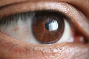 chirurgie des yeux