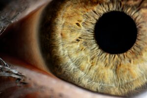 opération des yeux