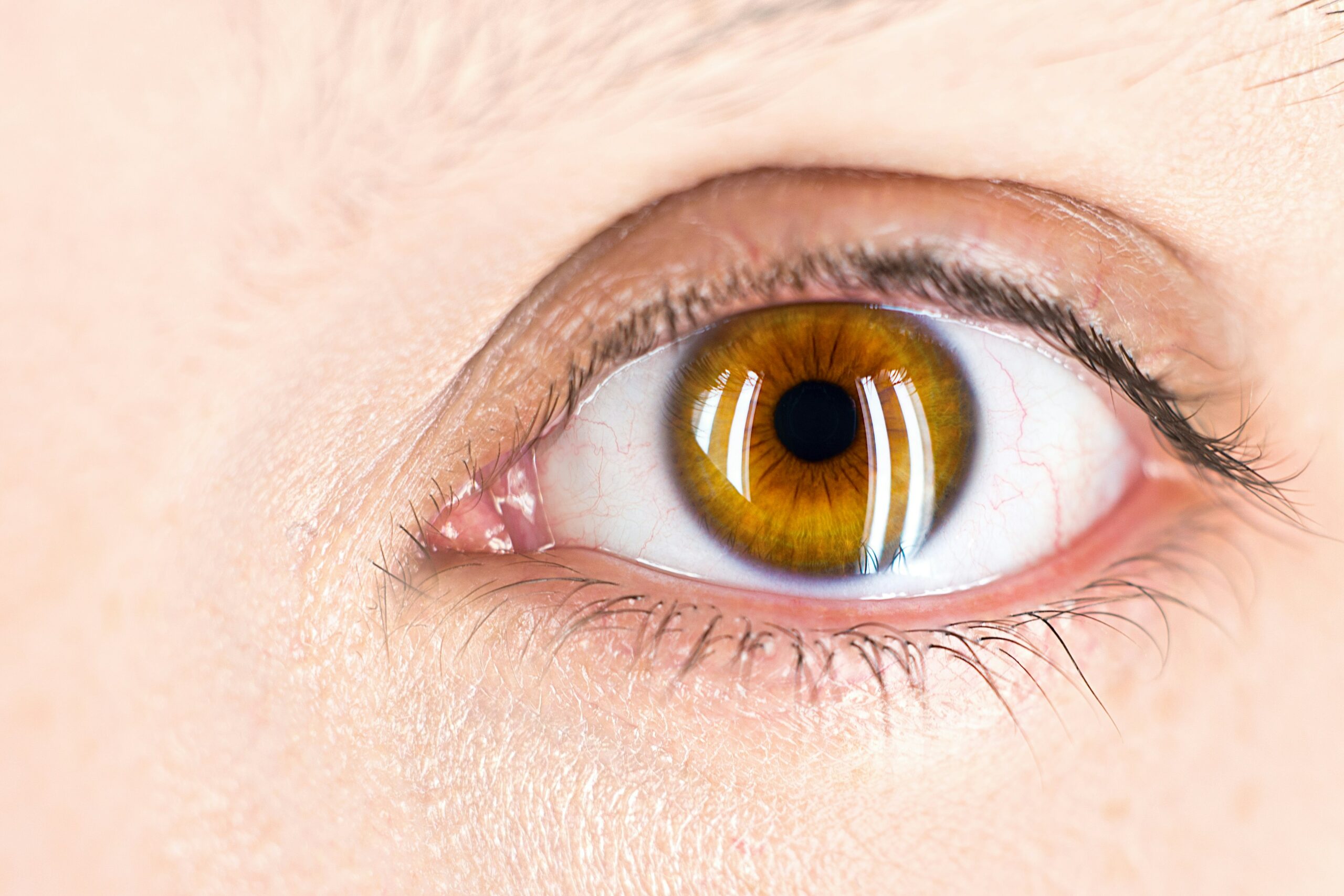 centre laser pour les yeux