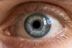 bilan préopératoire de chirurgie réfractive
